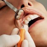 dentist performing important dental checkups