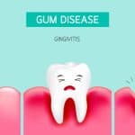 progression of gum disease from healthy to gingivitis to periodontitis